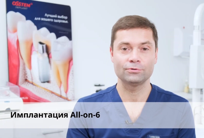 Имплантация зубов по методу All on 6 или «Всё на шести»