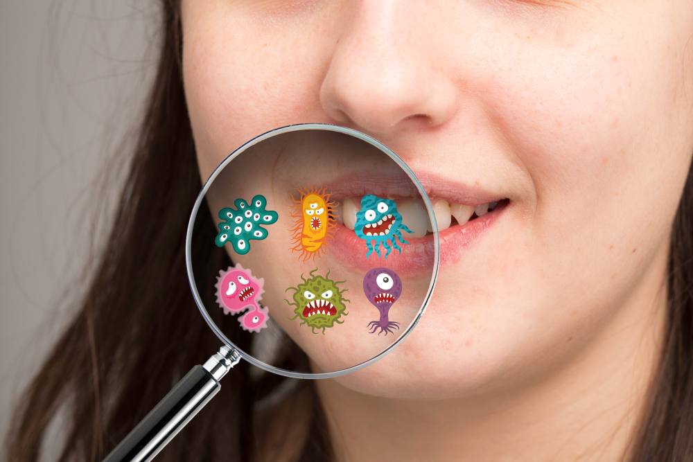 Бактериальная флора в полости рта часто приводит к неприятному запаху