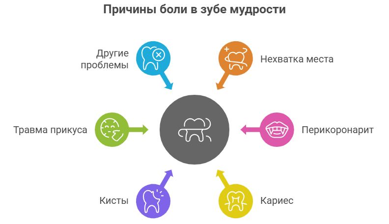 Причины боли в зубе мудрости