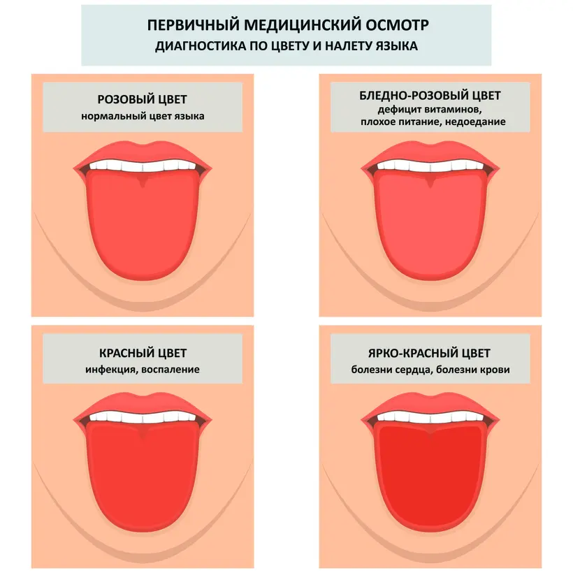 Диагностика по цвету и налету языка первая часть фото