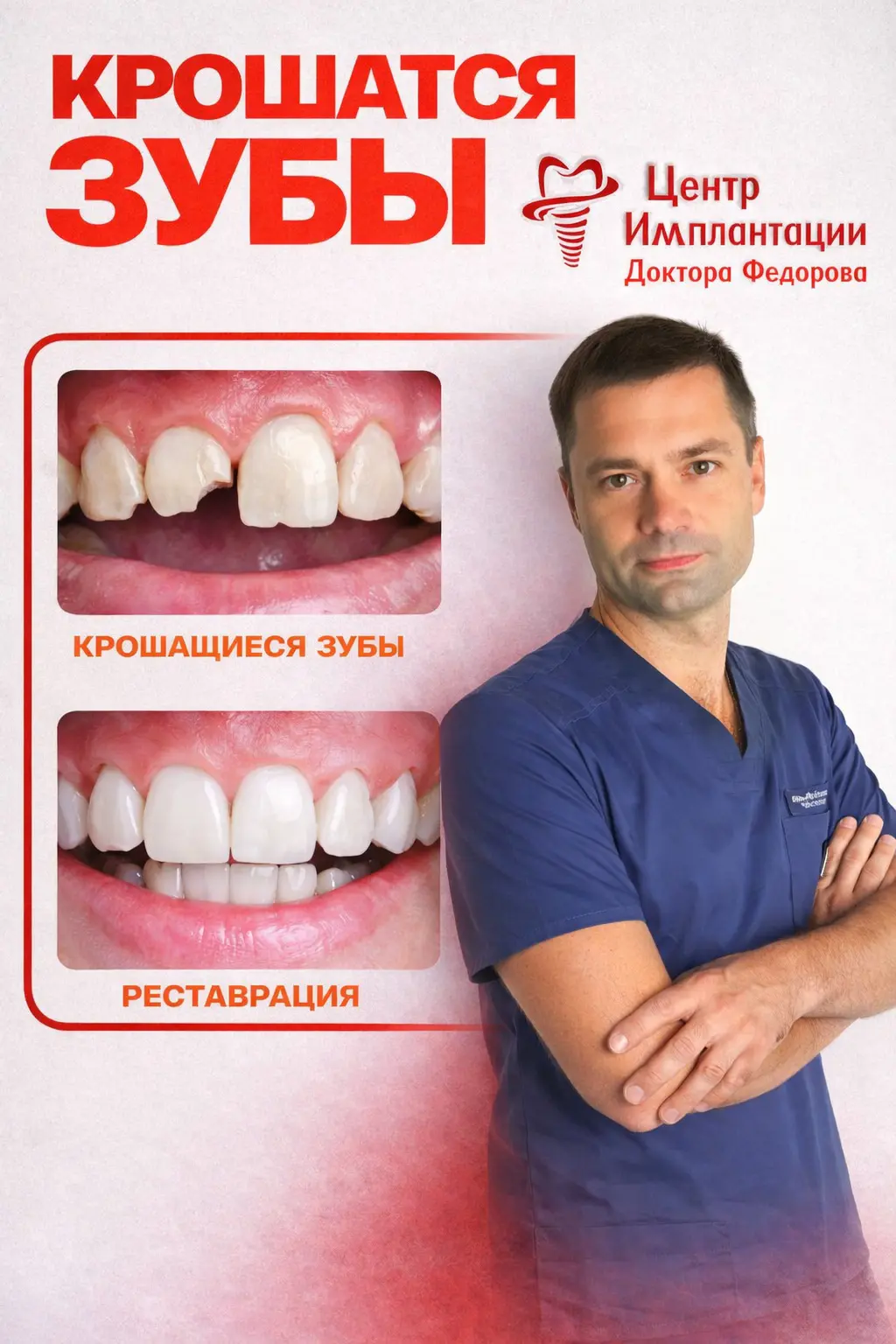 Лечение крошащихся зубов в центре Имплантации Доктора Федорова