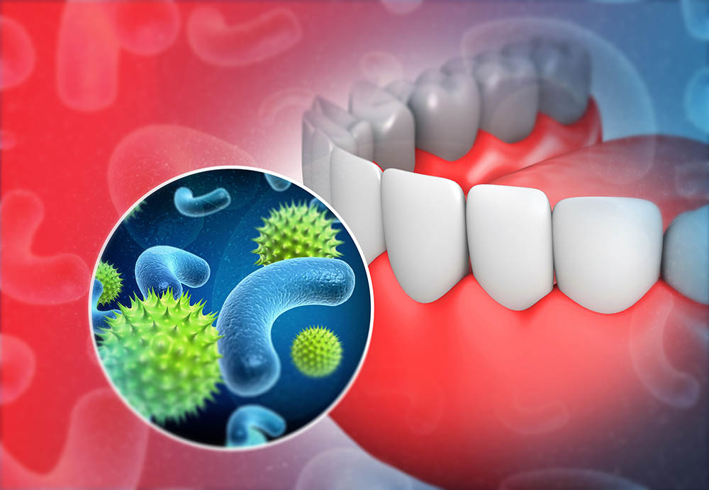 Патогенные бактерии в полости рта