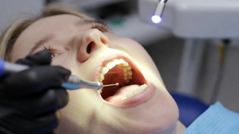 Пациент во время фторирования зубов у стоматолога