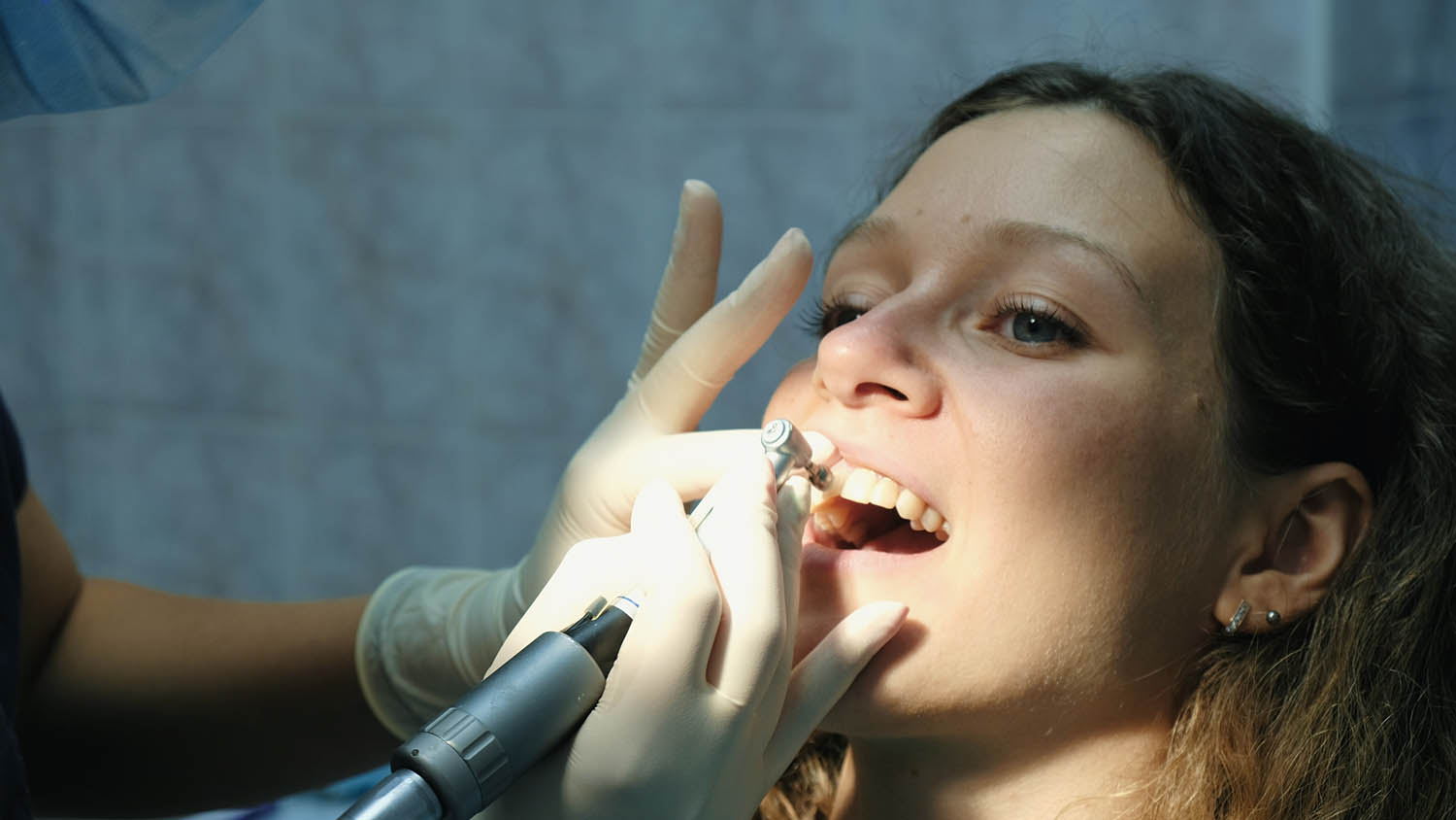 Профгигиена зубов – полирование эмали