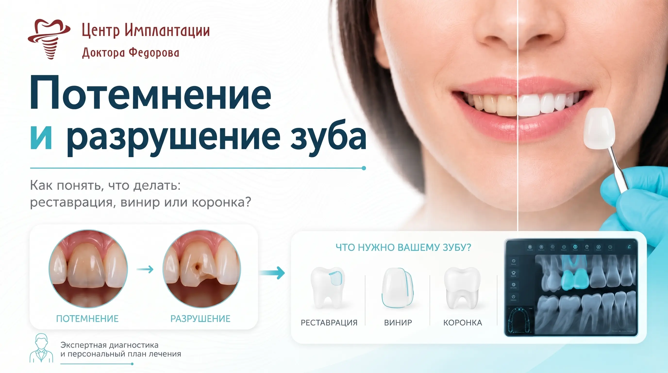 Инфографика: потемнение и разрушение зуба - причины
