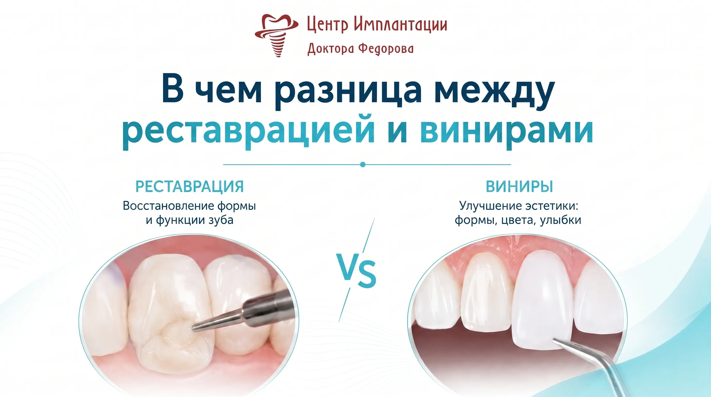 Инфографика: разница между реставрацией и винирами