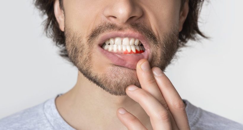 Боль в десне после удаления зуба