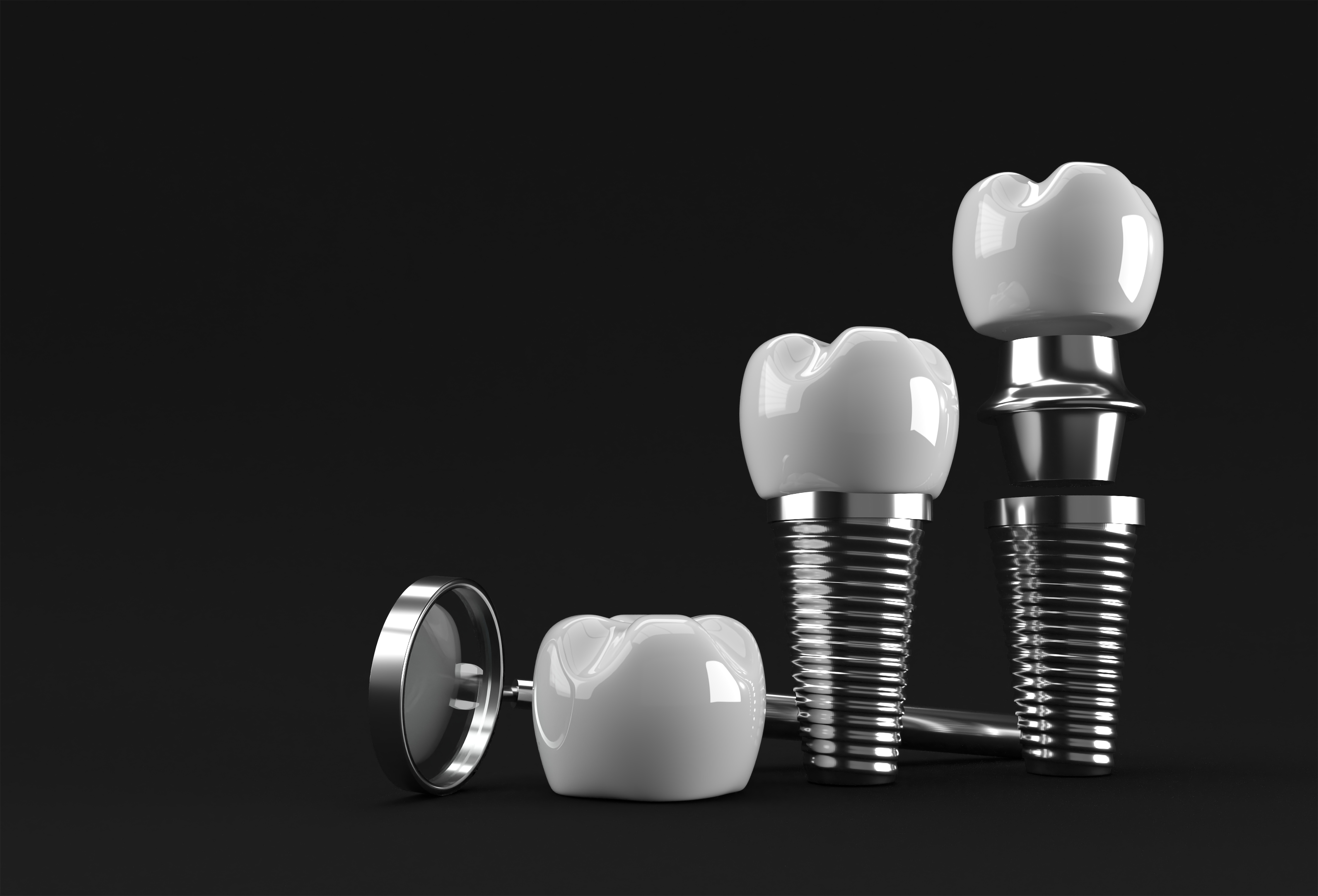 Устройство зубного импланта: титановый стержень, абатмент и коронка