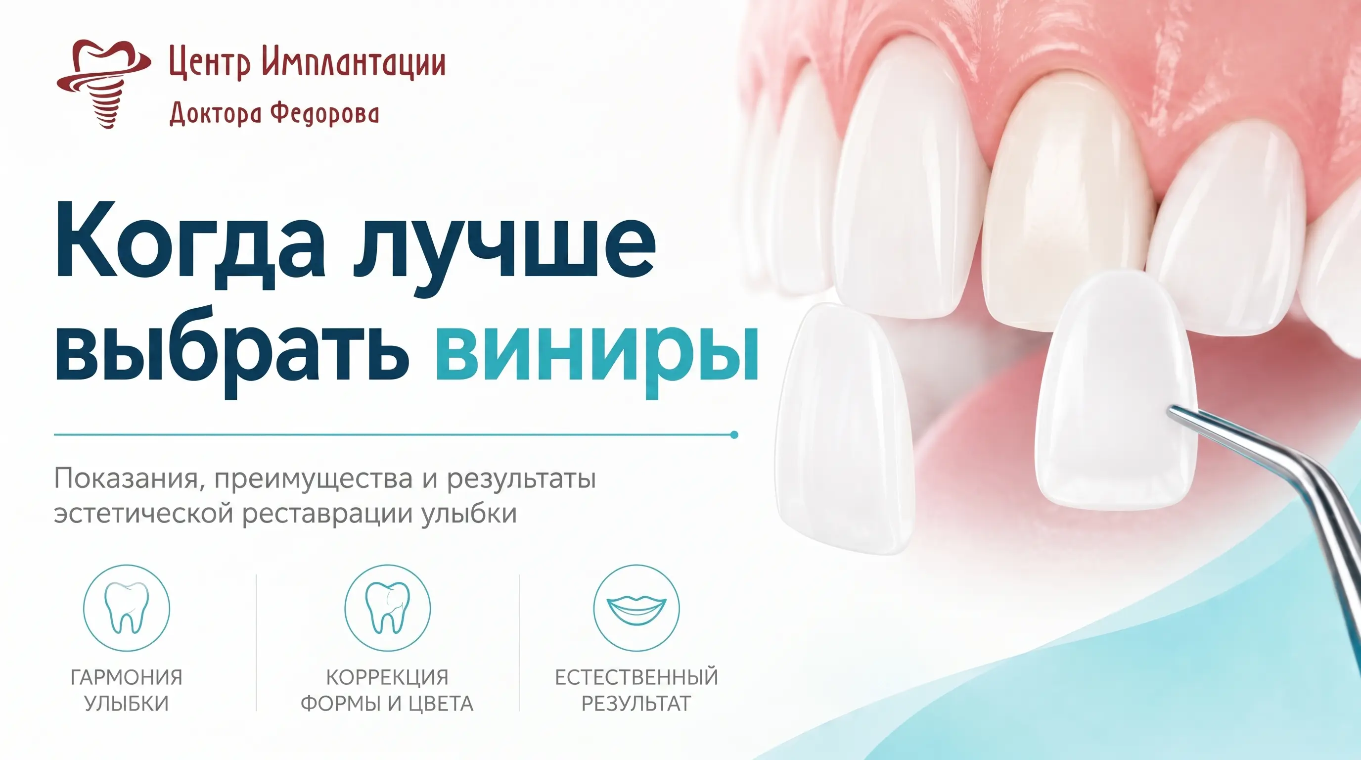 Инфографика: когда лучше выбрать виниры