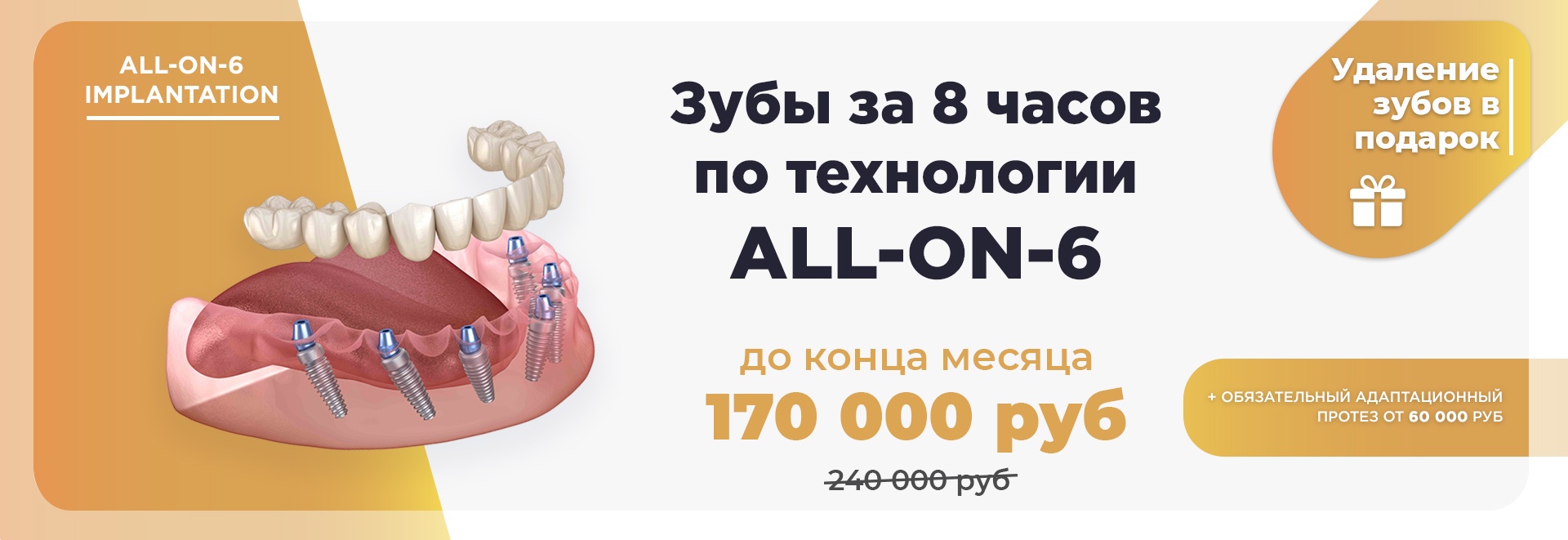 Зубы за 1 день по технологии all-on-6 - implantolog-fedorov.ru