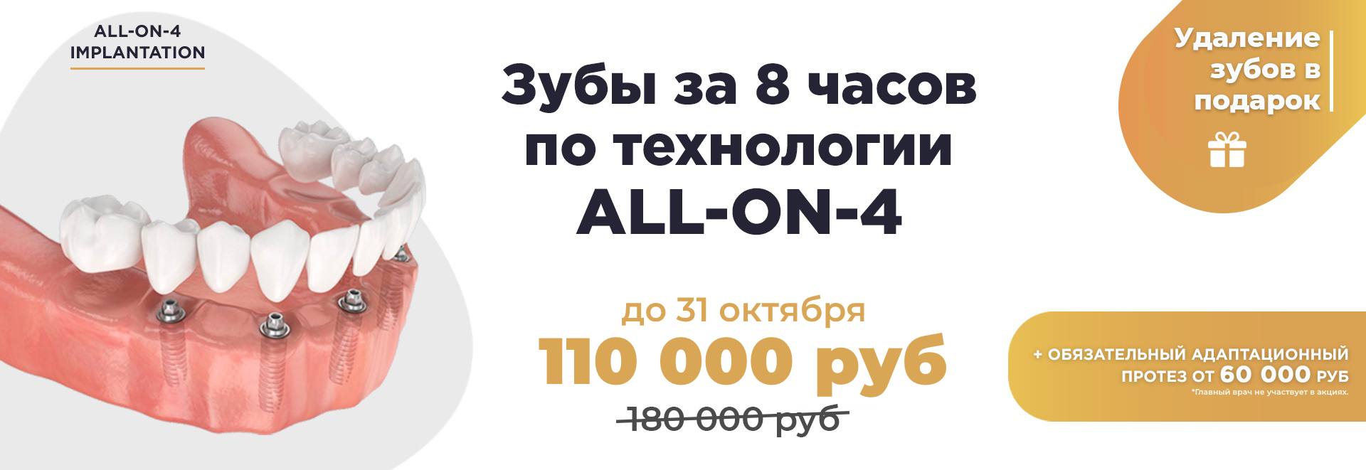 Зубы за 1 день по технологии all-on-4 - implantolog-fedorov.ru