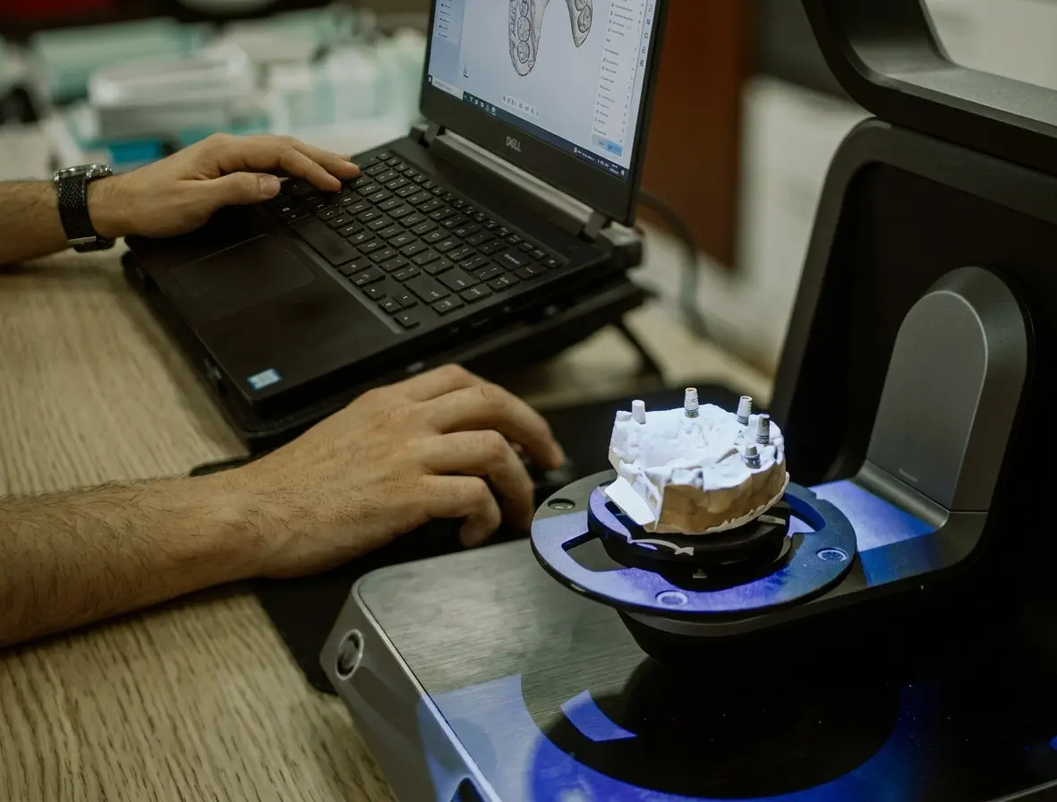 Техник сканирует гипсовую модель зубов на 3D-сканере в лаборатории