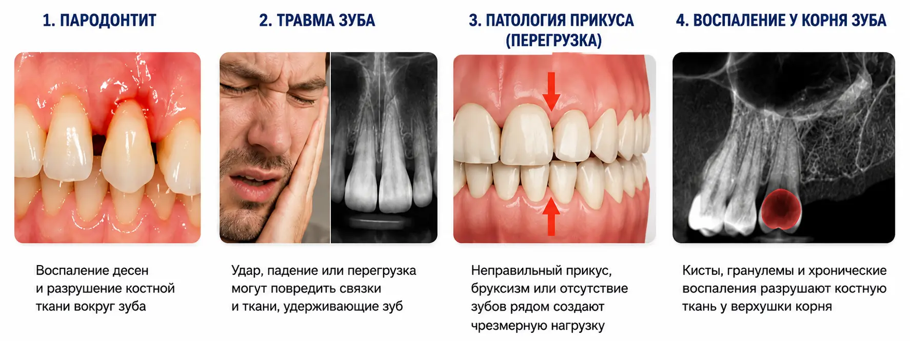 Почему начинает шататься зуб