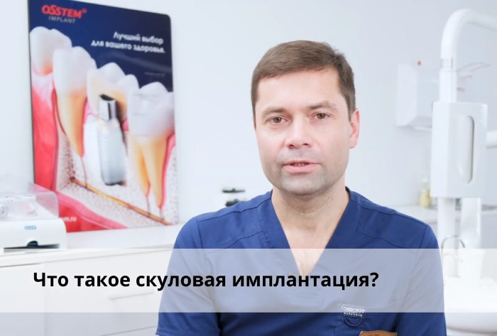Скуловая имплантация зубов
