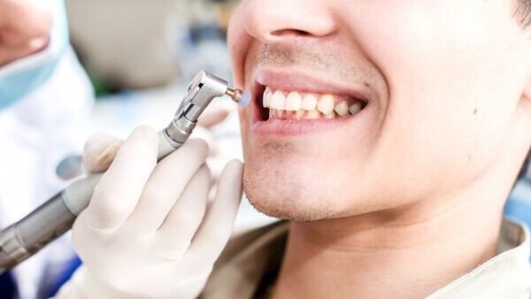 Важности профессиональной чистки зубов