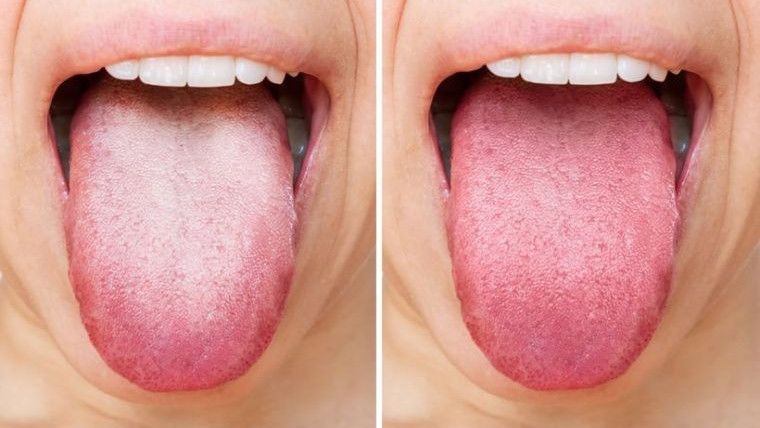Стоматологическое заболевание, провоцирующее появление красной сыпи во рту