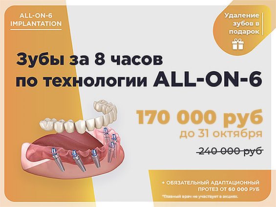 Имплантация All-on-6
