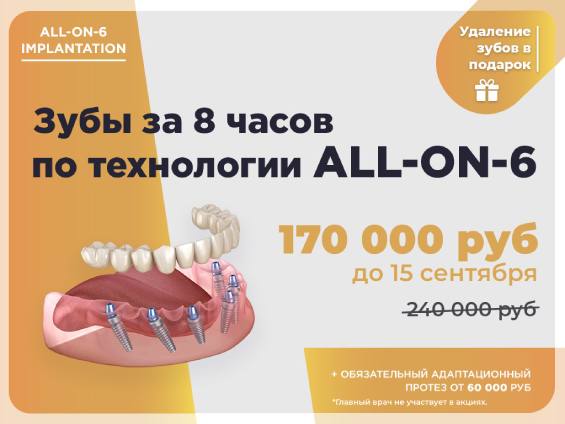 Имплантация All-on-6