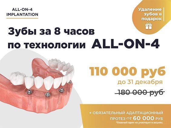 All-on-4 Nobel (новая)