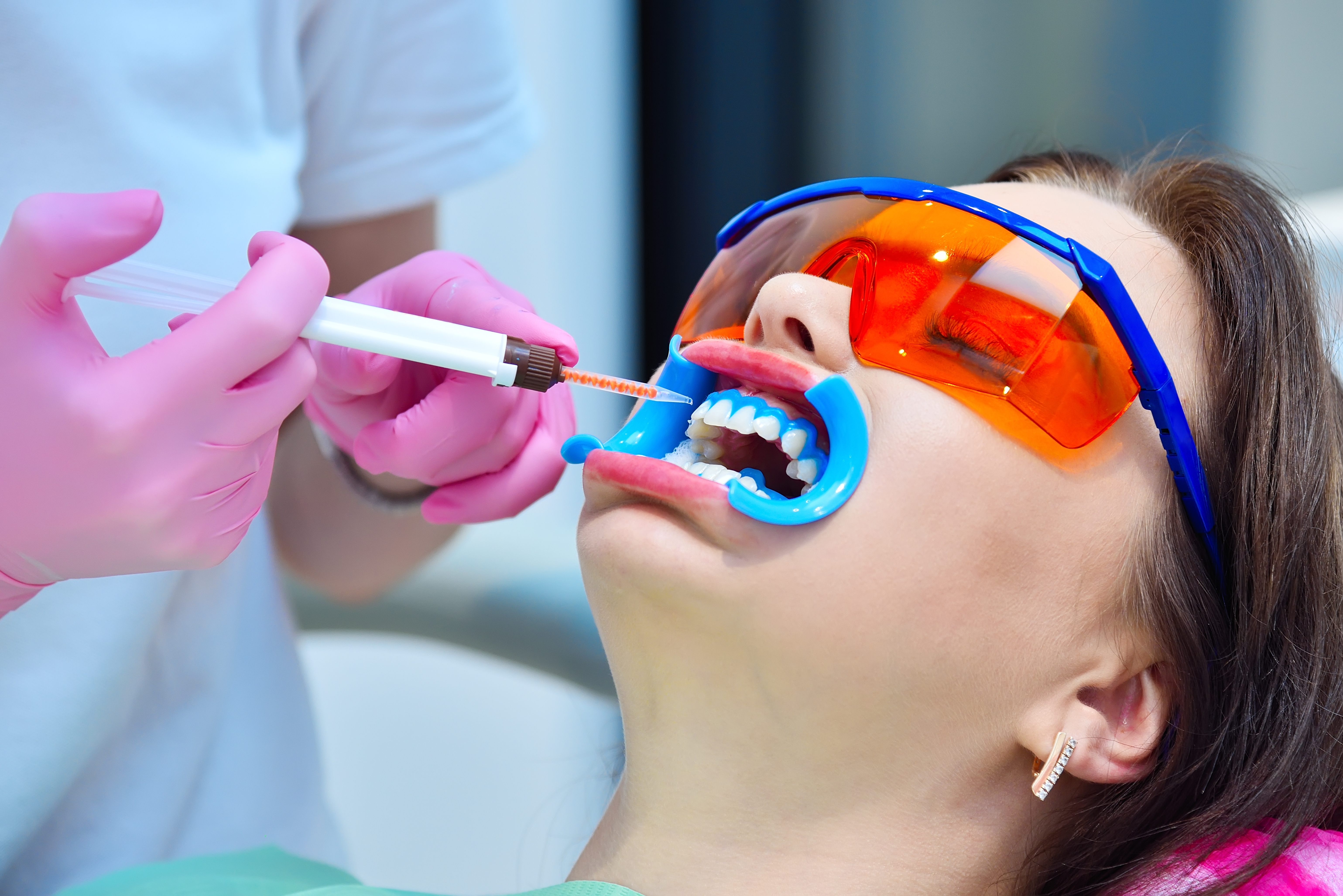 Стоматолог наносит отбеливающий гель пациентке на зубы