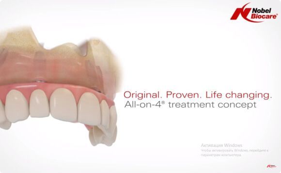 Протокол имплантация зубов Все-на-6